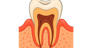 Tooth Drawing